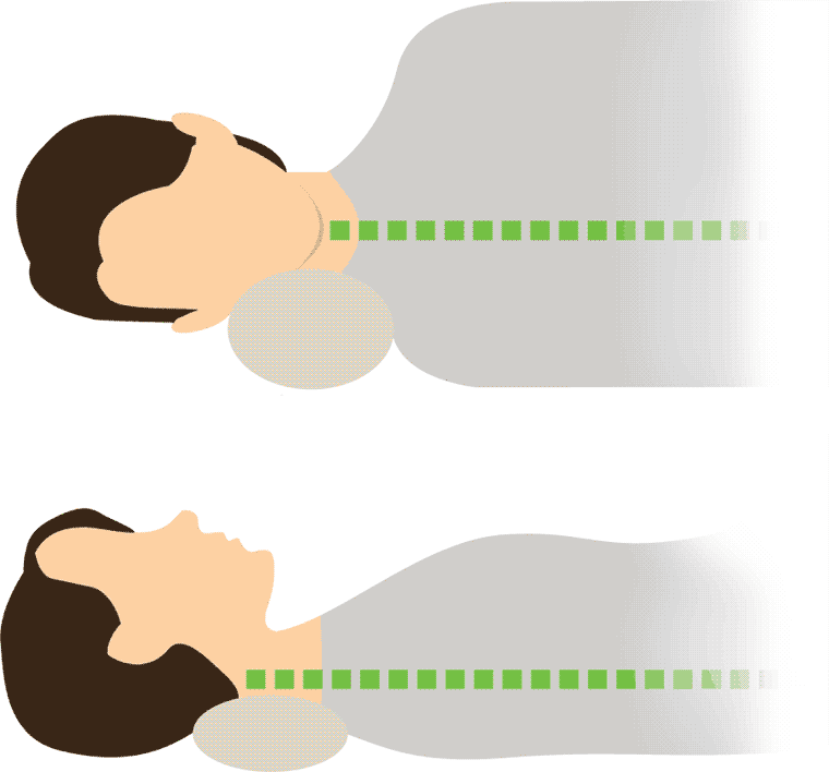 Diagram of bolster pillow support for side sleepers and back sleepers